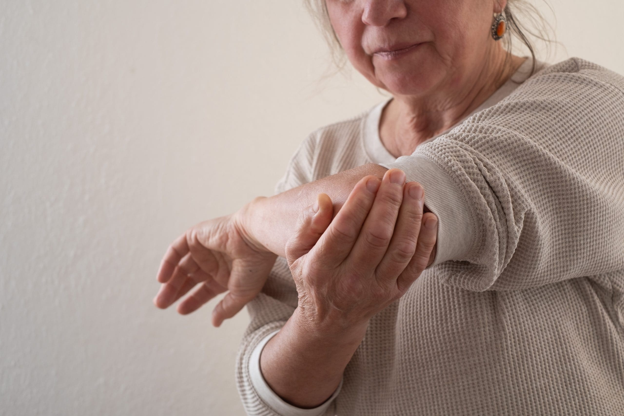 a woman suffering post surgical stiffness